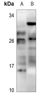 1 - Anti-MOB3C Antibody AP53305