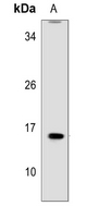 1 - Anti-MRPL41 Antibody AP53306