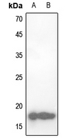 1 - Anti-CBP20 Antibody AP53309