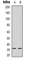 1 - Anti-NGF beta Antibody AP53311
