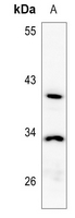 1 - Anti-NXPH3 Antibody AP53313