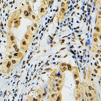 19 - Anti-PRPF39 Antibody AP53315