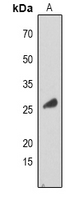 1 - Anti-RAB34 Antibody AP53316