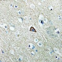 19 - Anti-RhoG Antibody AP53317