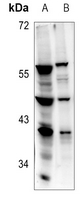 1 - Anti-RPL5 Antibody AP53318