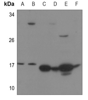 1 - Anti-RPS13 Antibody AP53320