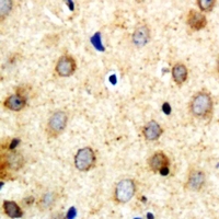 19 - Anti-SAR1B Antibody AP53321