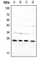 1 - Anti-SAR1B Antibody AP53321
