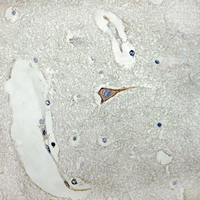 19 - Anti-SCN4B Antibody AP53322