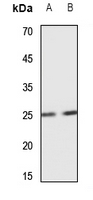 1 - Anti-SCN4B Antibody AP53322