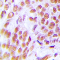 19 - Anti-ZNF265 Antibody AP53326