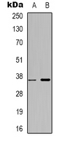 1 - Anti-ZNF265 Antibody AP53326