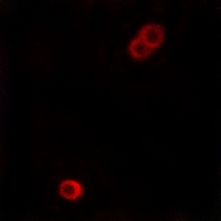 3 - Anti-ACER3 Antibody AP53329