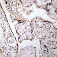 19 - Anti-ACER3 Antibody AP53329