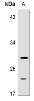 1 - Anti-ACER3 Antibody AP53329