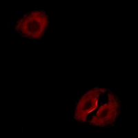 3 - Anti-Collagen 19 alpha 1 Antibody AP53336