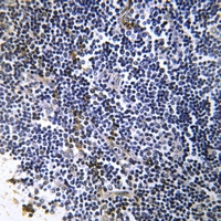 19 - Anti-Collagen 19 alpha 1 Antibody AP53336