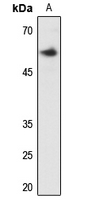 1 - Anti-Clipin A Antibody AP53337