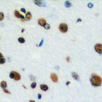19 - Anti-CstF-64T Antibody AP53338