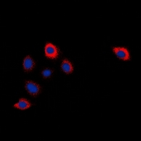 3 - Anti-Cytochrome P450 2W1 Antibody AP53339