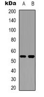 1 - Anti-Cytochrome P450 2W1 Antibody AP53339
