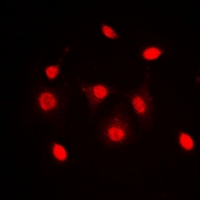 3 - Anti-Dyskerin Antibody AP53340