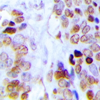 19 - Anti-Dyskerin Antibody AP53340