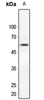 1 - Anti-Dyskerin Antibody AP53340