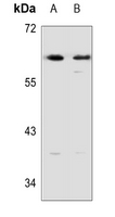1 - Anti-DOK1 Antibody AP53342