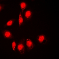 3 - Anti-DPF2 Antibody AP53343