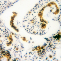 19 - Anti-EGFR (Phospho-S1026) Antibody AP53344