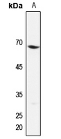 1 - Anti-EIF3D Antibody AP53345