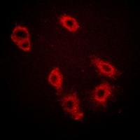 3 - Anti-HER3 (Phospho-Y1222) Antibody AP53346