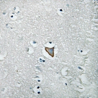 19 - Anti-HER3 (Phospho-Y1222) Antibody AP53346