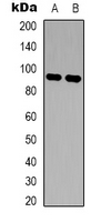 1 - Anti-c-FER Antibody AP53347