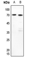 1 - Anti-FUBP3 Antibody AP53348