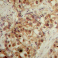 19 - Anti-LONP2 Antibody AP53352