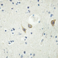 19 - Anti-LTK Antibody AP53353