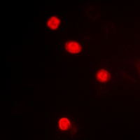 3 - Anti-MAPKAPK3 Antibody AP53354