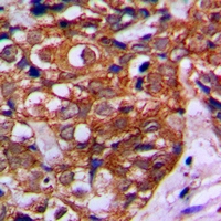 19 - Anti-MVK Antibody AP53356