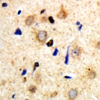 19 - Anti-Myosin 14 Antibody AP53357