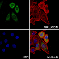 3 - Anti-PABPC5 Antibody AP53359