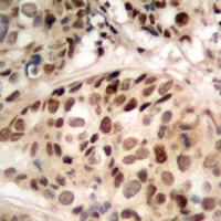 19 - Anti-PHF1 Antibody AP53360