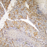 19 - Anti-PI3K p110 gamma Antibody AP53361