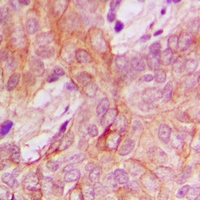 19 - Anti-PPM1K Antibody AP53362