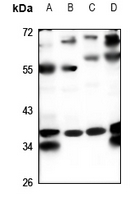 1 - Anti-PPM1K Antibody AP53362