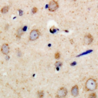 19 - Anti-PSMD11 Antibody AP53365