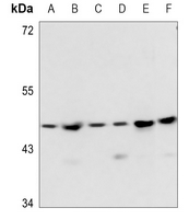 1 - Anti-PSMD11 Antibody AP53365
