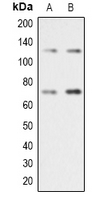 1 - Anti-RAD21 Antibody AP53366