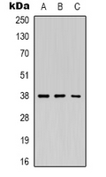 1 - Anti-Renin Antibody AP53367